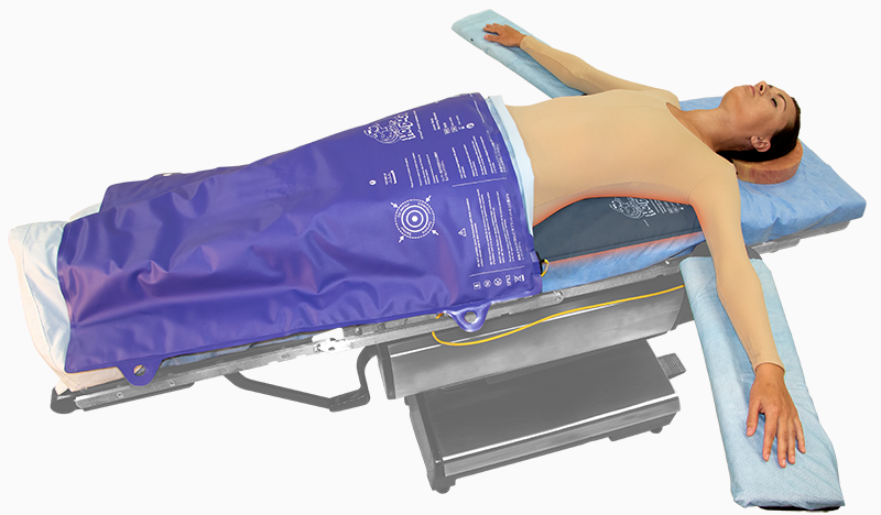 Patient on Operating Table with a HotDog U502 warm grounding pad and B103 Full Body Warming Blanket.