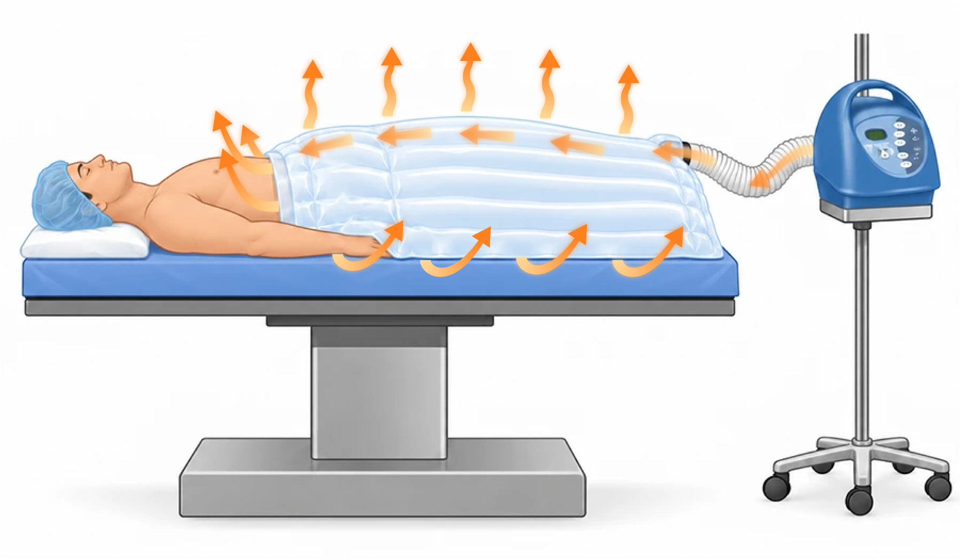 Bair Hugger forced-air warming system with heated air flowing through an inflatable blanket and excess heat escaping around the patient.