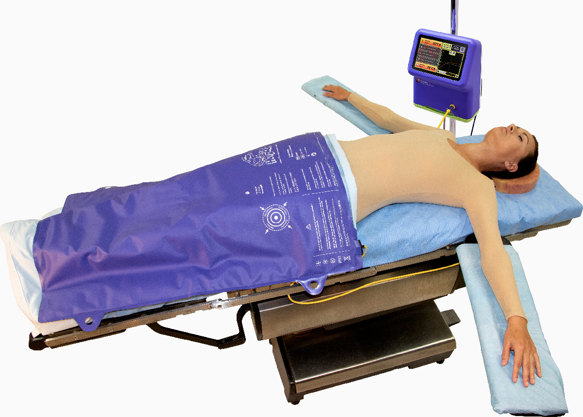 HotDog Patient Warming system on Patient with B103 Lower Body Warming Blanket and WC77 Temperature Management Controller